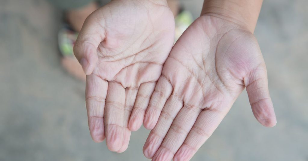 Patients have reported wrinkled fingers and other strange symptoms