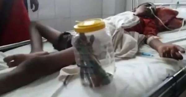 A teenager swallows 16 toothbrushes and undergoes surgery;  See more - International
