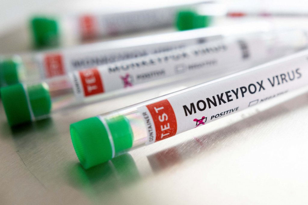 The number of monkeypox cases in Spain has risen to 51