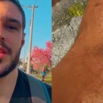 Rodrigo Mossi shows a scraped knee after falling on a bike