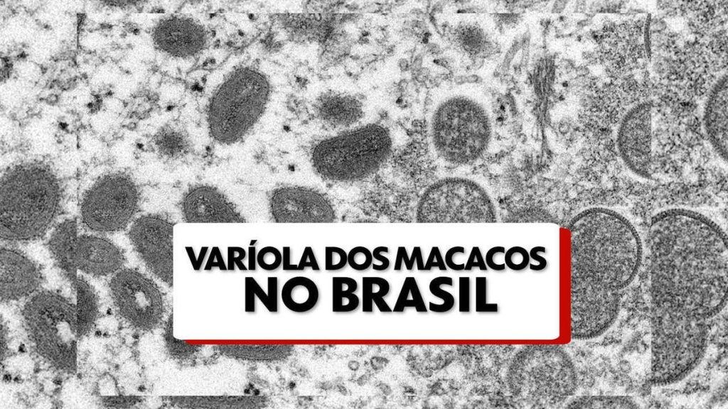 The Ministry of Health issues guidelines after the first case of monkeypox in Salvador |  Bahia